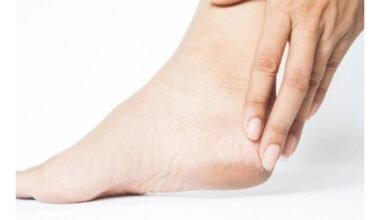 išgydyti suskilinėjusias kulnus namuose