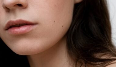 apgamų vietos skruostų šonuose