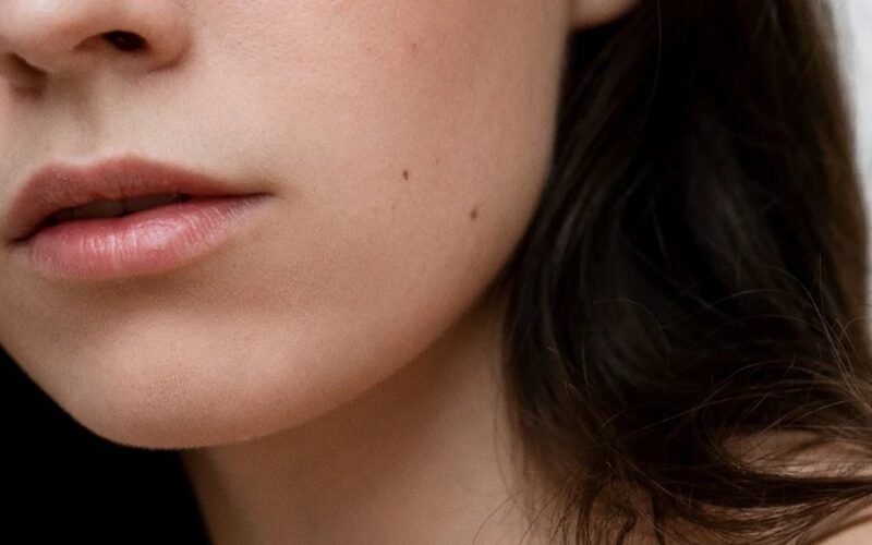 apgamų vietos skruostų šonuose